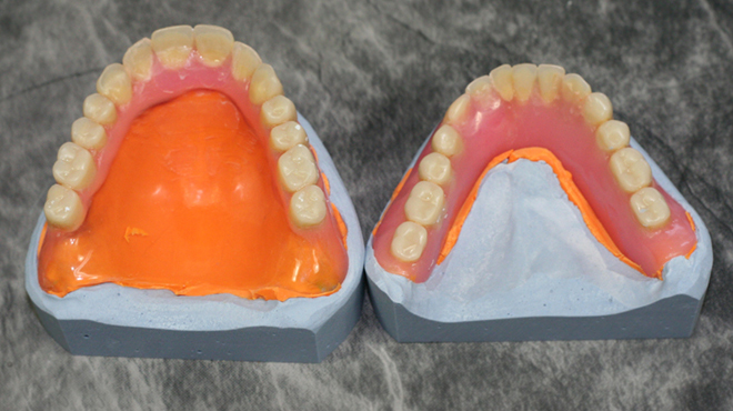Zubní protéza – kopírovat či nekopírovat?