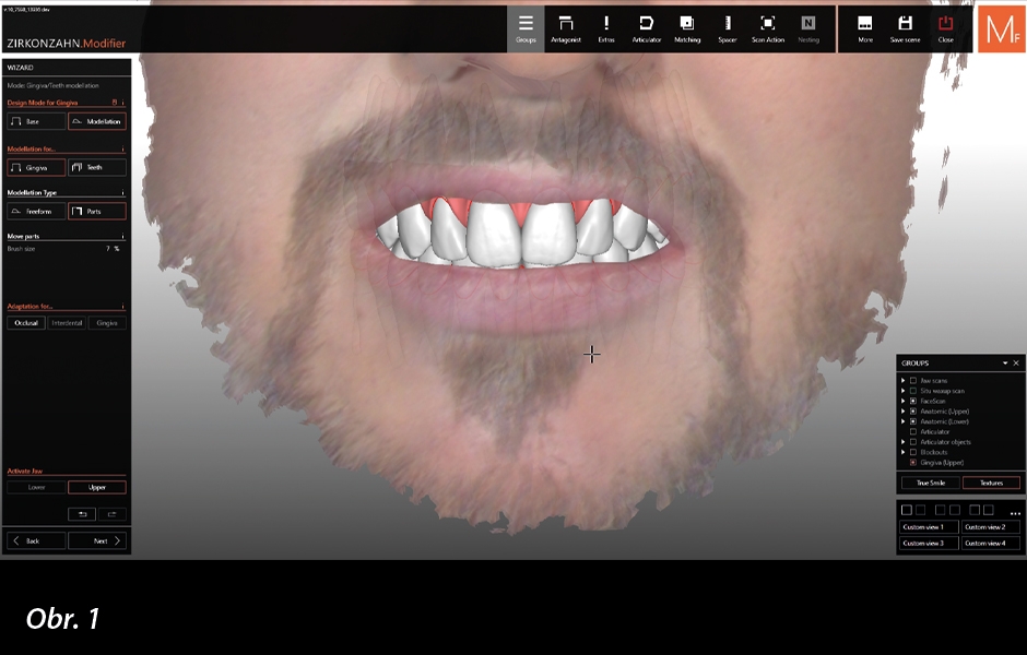 Sestavení zubů odpovídající anatomie vybraných z virtuální knihovny Heroes Collection, která je součástí softwaru.