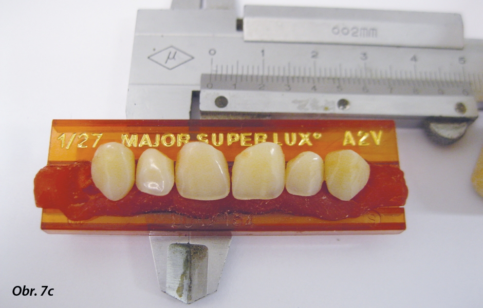 Obr. 7a–c: Výběr a individualizace konfekčních zubů Major Super Lux.