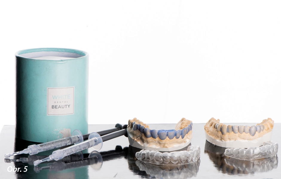 Bělicí gel značky White Dental Beauty, výrobce Opti dent a nosiče pro domácí bělení. Standardním způsobem, nanesením vosku na bukální plošky zubů na pracovním modelu, vytvoříme zásobníky pro bělicí gel.