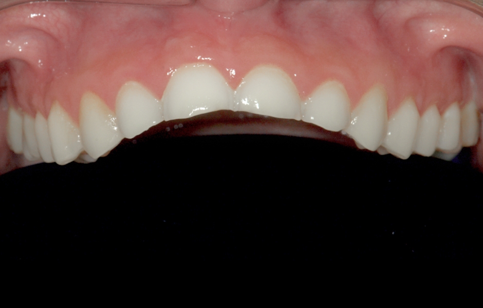 Obr. 2: Situace při ortodontické léčbě.