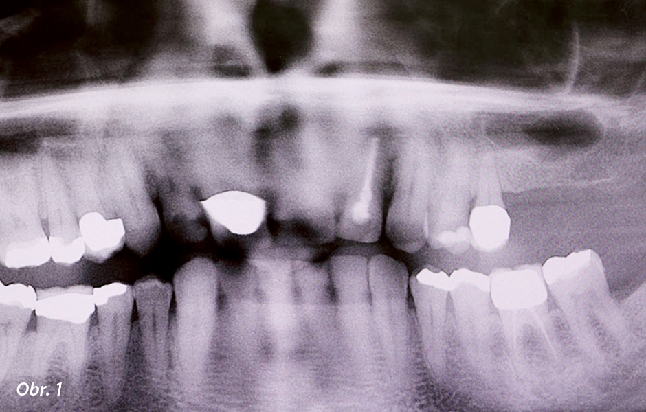 Celkově dobrý zdravotní stav dutiny ústní – panoramatický rtg snímek.