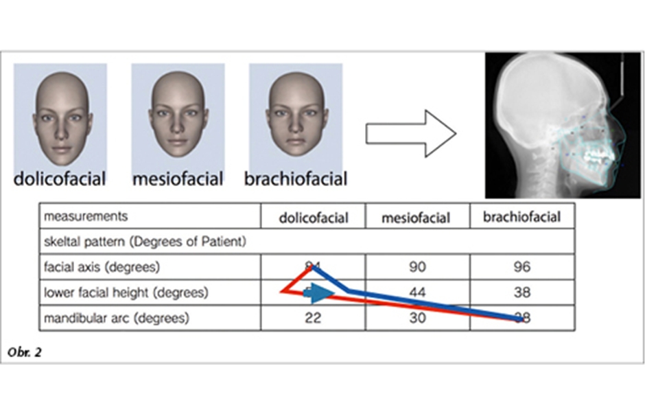 Obr. 2: Vyhodnocení estetických obličejových parametrů