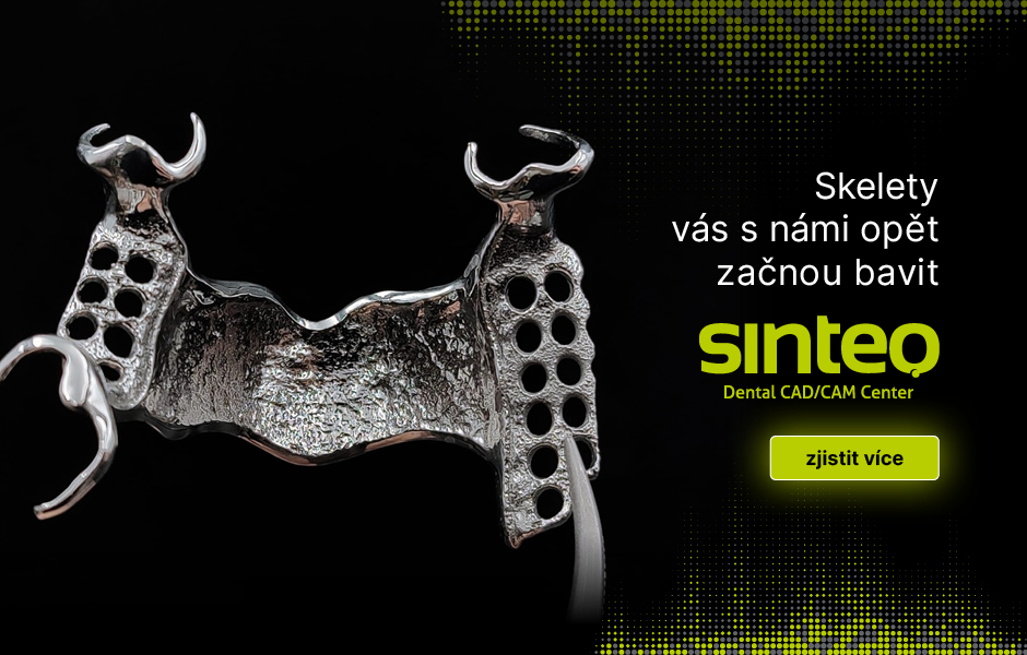 https://sinteo.cz/technologie/slm/