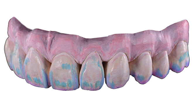 Společnost Kuraray Noritake Dental Inc. oznamuje uvedení materiálu Esthetic Colorant pro zirkon KATANA™ Zirconia na český trh