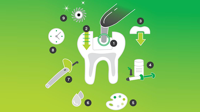 Bulk-fill kompozity: fakta a klíčové faktory úspěchu Bulk-fill kompozity: fakta a klíčové faktory úspěchu