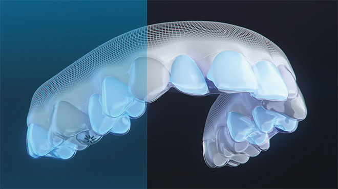 Align Technology představuje Invisalign® Moderate package, řešení pro léčbu mírných a středních malookluzí