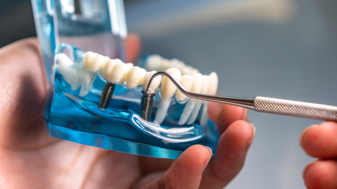 Plán na ochranu implantátů Plán na ochranu implantátů
