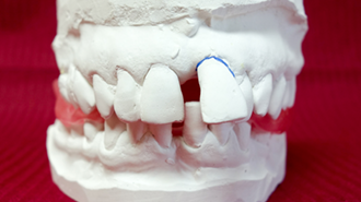 Liečba parodontitídy pri spolupráci zubného lekára a dentálnej hygieničky