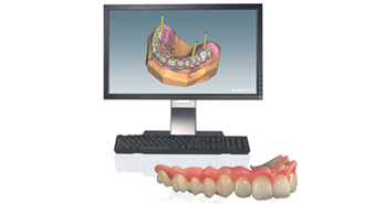 Ceramill RE(L)AX