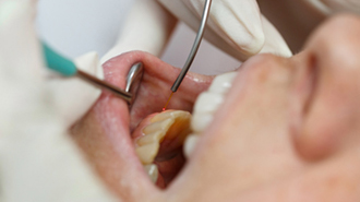 Návratnost investic do zubních laserů – vzdělávání a technologie