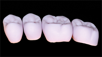 Zlatý standard pro náhrady vyráběné v zubní ordinaci