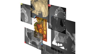 Využití CBCT ve stomatologii i mimo ni