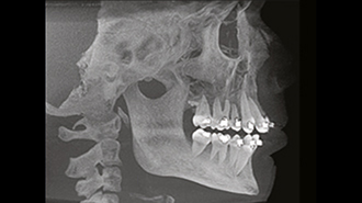 Použití technologie Cone Beam v ortodoncii