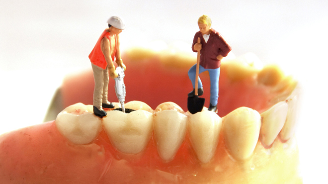 Nový materiál pro rekonstrukci zubů nabízí vylepšení oproti plnivům na bázi akrylátů