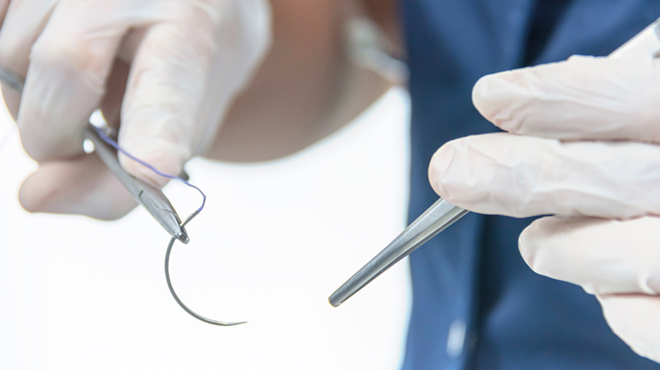 Plastická chirurgie parodontu  Správné buňky, správné místo, správný čas 