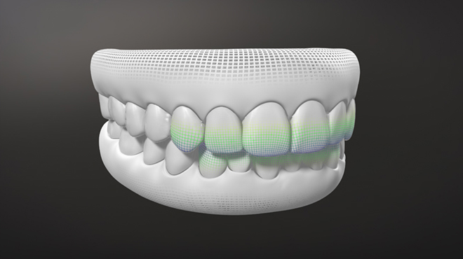 Align Technology představuje Invisalign® G8, systém s novými aktivačními funkcemi