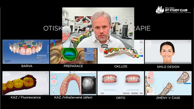 Pusťte si webinář MUDr. Kunkely „Permanentní protetické náhrady pomocí 3D tisku“ 