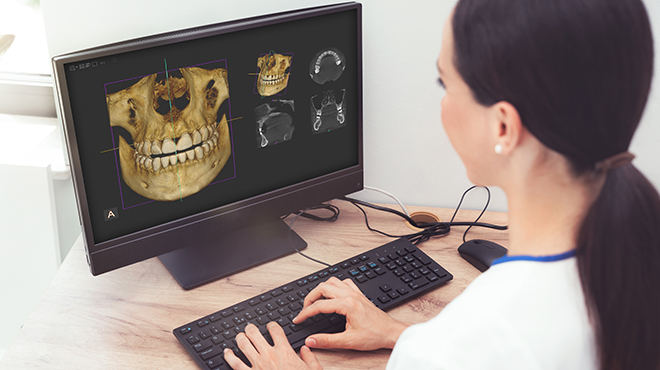 Nová funkce plánovacího softwaru ClinCheck: integrace CBCT