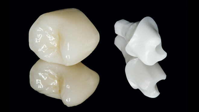 CAD/CAM abutment a korunka v jediném kroku