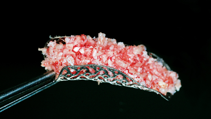 Regenerace tkáňového defektu a mnohočetná implantace Regenerace tkáňového defektu a mnohočetná implantace
