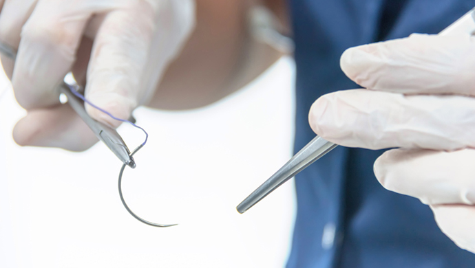 Plastická chirurgie parodontu Správné buňky, správné místo, správný čas Plastická chirurgie parodontu Správné buňky, správné místo, správný čas