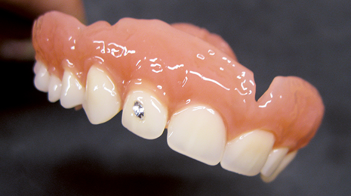 Celková individualizovaná snímatelná náhrada – technologický tip pro práci s konfekčními zuby