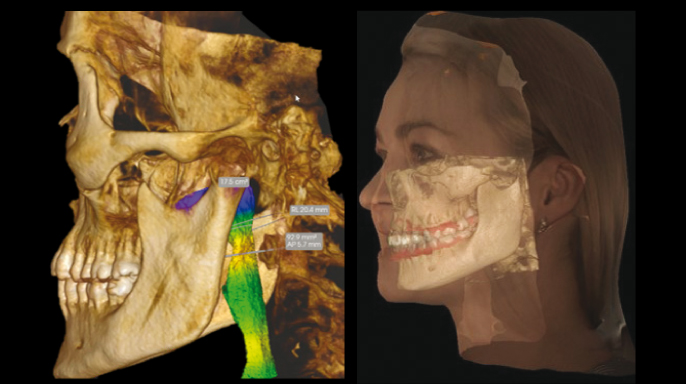 3D zobrazení otevírá oči. Široké možnosti a budoucnost využití CBCT