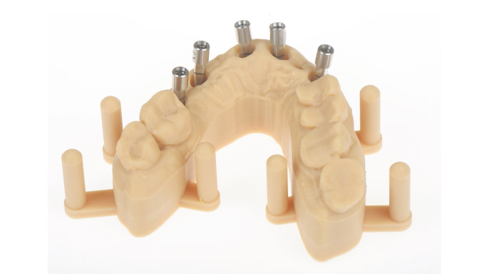 Digitální workflow v dentálních technologiích – 1. část