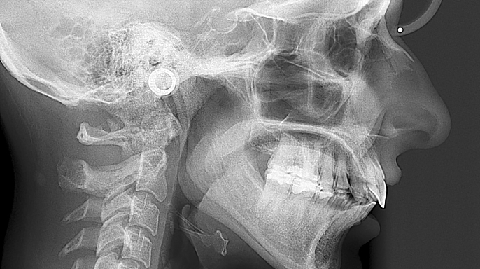 5 aspektů, kterými DentalMonitoring výrazně zlepšuje mou ortodontickou léčbu