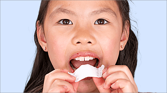 Align Technology uvedla v Evropě systém Invisalign Palatal Expander