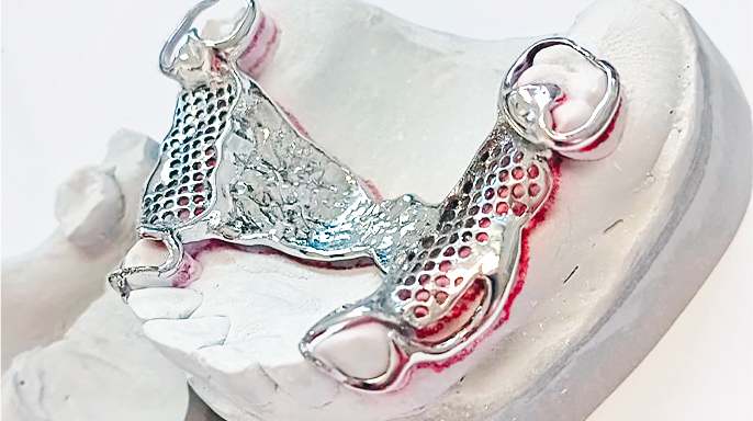 3D tištěné skelety: přesnost 3D tisku a nadbytečnost opakeru 3D tištěné skelety: přesnost 3D tisku a nadbytečnost opakeru