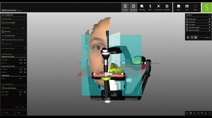 Přenos dat pacienta z digitální do analogové podoby a naopak