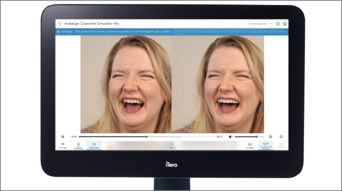 Align Technology představuje inovace pro iTero™ Digital Solutions ekosystém