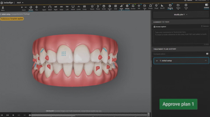 ClinCheck signature experience: Cesta zubního lékaře k digitálnímu mistrovství