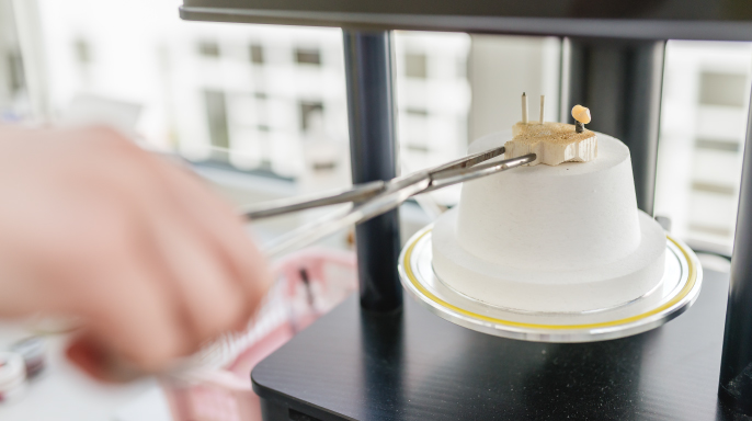 Anatomické zirkonové korunky: Proč se staly standardem  v moderní protetice