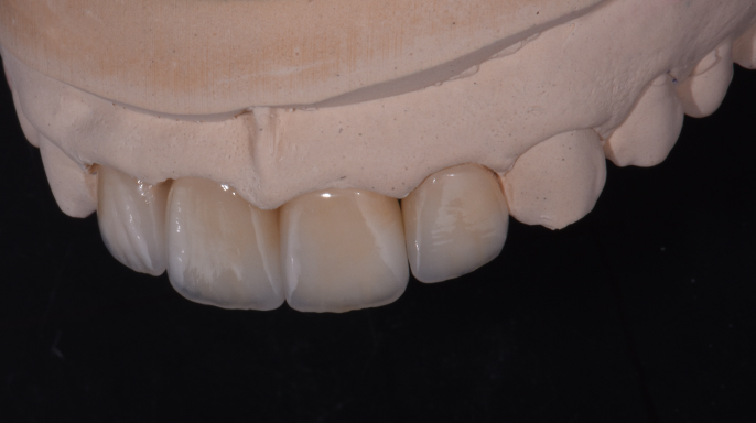 Cesta k novému úsměvu: kazuistika