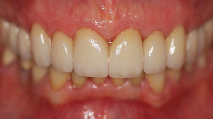 Smile dysmorphia - Co se skrývá v úsměvu... více, než si dokážete představit Smile dysmorphia - Co se skrývá v úsměvu... více, než si dokážete představit