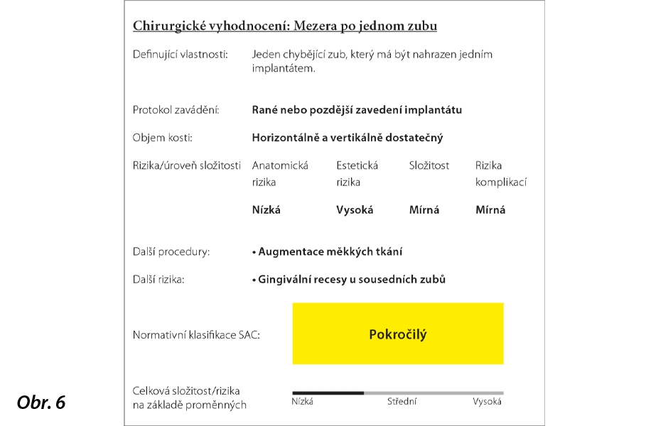 Prověřený digitální pracovní postup  se systémem Straumann CARES Digital Solutions a coDiagnostiX