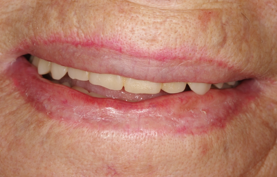 Obr. 3: Detail úsměvu pacientky před ošetřením.