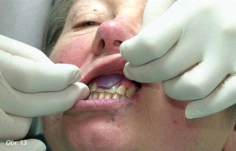 Zkouška modelu náhrady v zubní ordinaci
