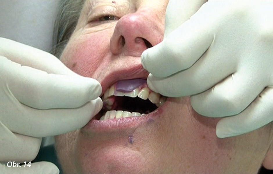 Zkouška modelu náhrady v zubní ordinaci
