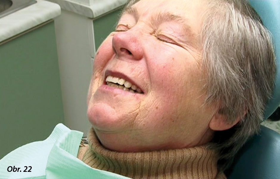 Začlenění náhrady do stomatognátního systému pacienta v zubní ordinaci