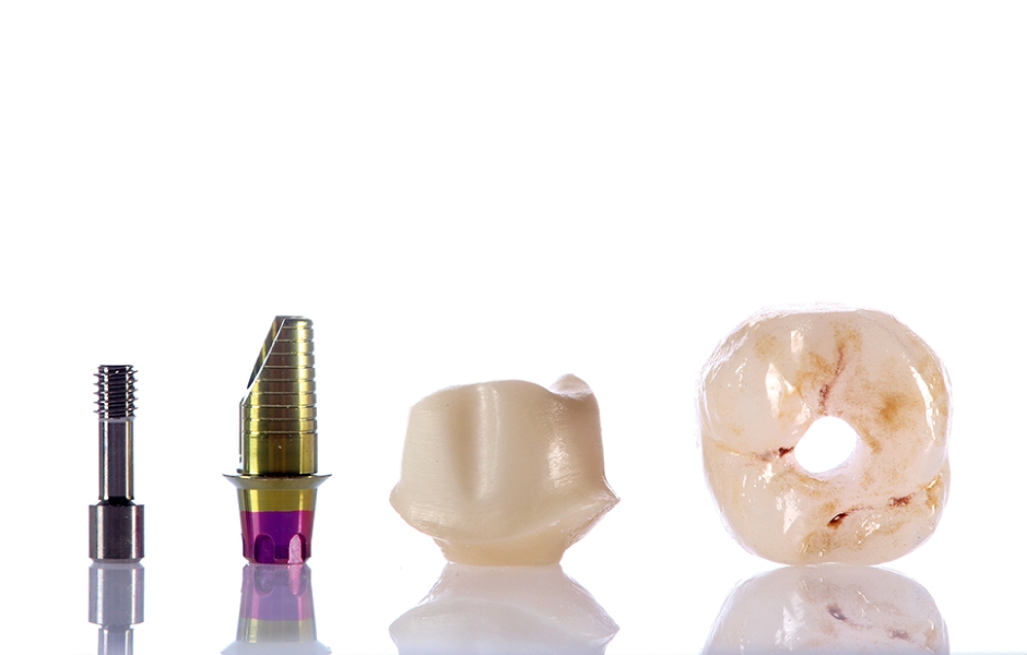 Obr. 16i: Hybridní korunková náhrada nesená implantátem.
