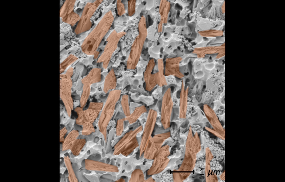 Obr. 1: SEM snímek materiálu Initial LiSi Press po leptání kyselinou fluorovodíkovou. Krystality lithium disilikátu byly úpravou snímku zbarveny oranžově – skelná fáze je šedá. Zdroj: Priv.-Doz. Dr. Renan Belli.