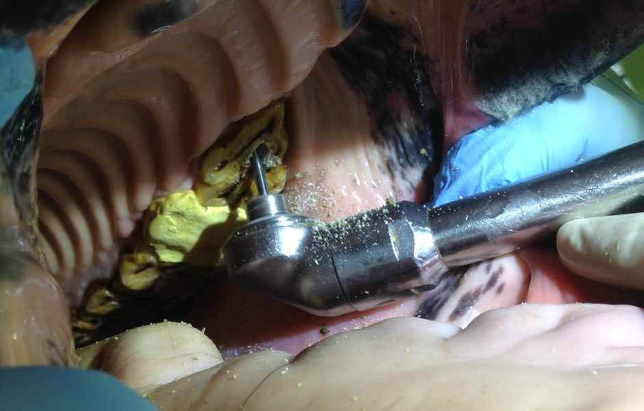 Restorativní ošetření infundibulárních kazů