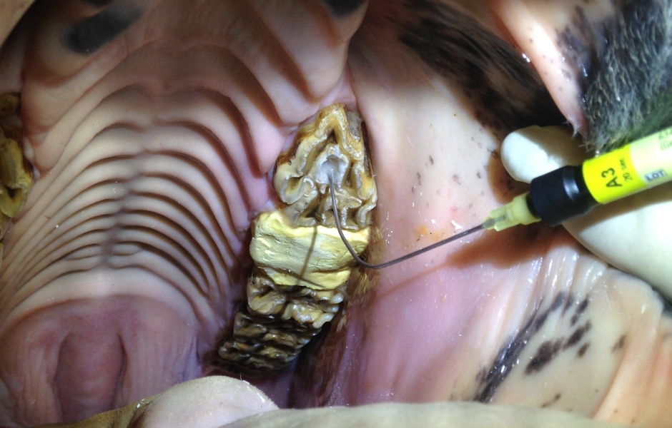 Restorativní ošetření infundibulárních kazů