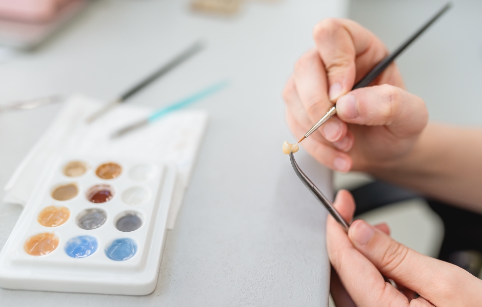 Anatomické zirkonové korunky: Proč se staly standardem v moderní protetice