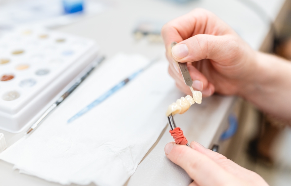 Anatomické zirkonové korunky: Proč se staly standardem v moderní protetice