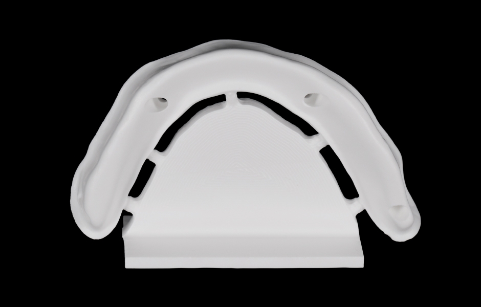 Obr. 3: Primární konstrukce ze zirkonie ICE Plus.